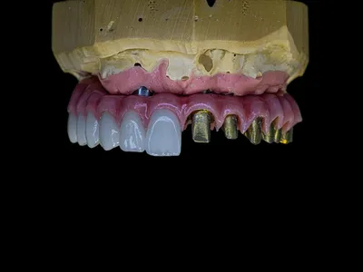Thimble Bar